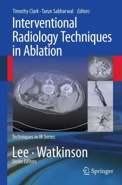Cover for Clark · Interventional Radiology Techniques in Ablation - Techniques in Interventional Radiology (Paperback Book) (2012)