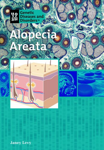 Cover for Janey Levy · Alopecia Areata (Genetic Diseases) (Hardcover Book) (2006)