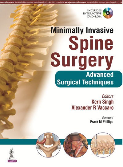 Cover for Kern Singh · Minimally Invasive Spine Surgery (Hardcover Book) (2015)