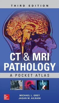 CT & MRI Pathology: A Pocket Atlas, Third Edition - Michael Grey - Kirjat - McGraw-Hill Education - 9781260121940 - keskiviikko 18. heinäkuuta 2018