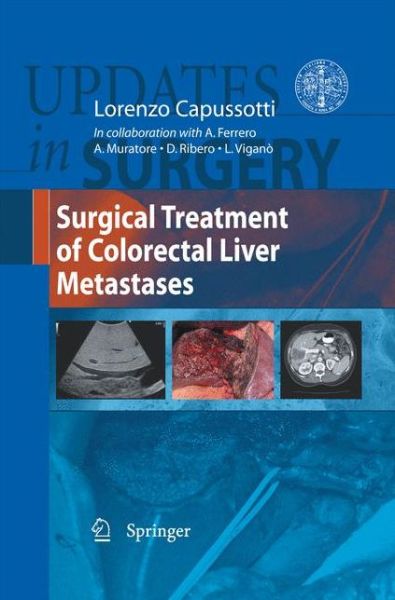 Cover for Lorenzo Capussotti · Surgical Treatment of Colorectal Liver Metastases - Updates in Surgery (Paperback Book) [2011 edition] (2014)