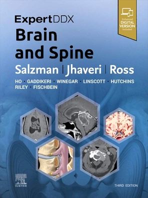 Cover for Salzman, Karen L. (Professor of Radiology and Imaging Sciences, Neuroradiology Section Chief and Associate Fellowship Director, Leslie W. Davis Endowed Chair in Neuroradiology, University of Utah School of Medicine, Salt Lake City, Utah) · ExpertDDx: Brain and Spine - ExpertDDx (Hardcover Book) (2023)