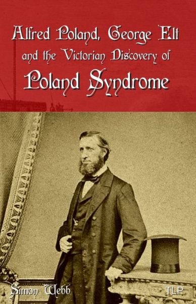 Alfred Poland, George Elt and the Victorian Discovery of Poland Syndrome - Simon Webb - Books - Independently Published - 9781098989941 - May 16, 2019