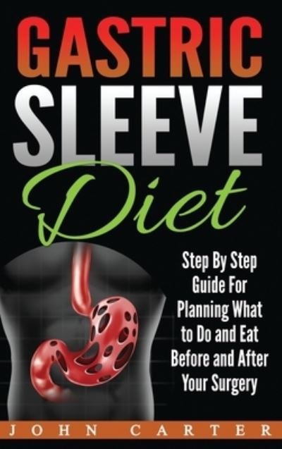 Cover for John Carter · Gastric Sleeve Diet (Hardcover Book) (2019)