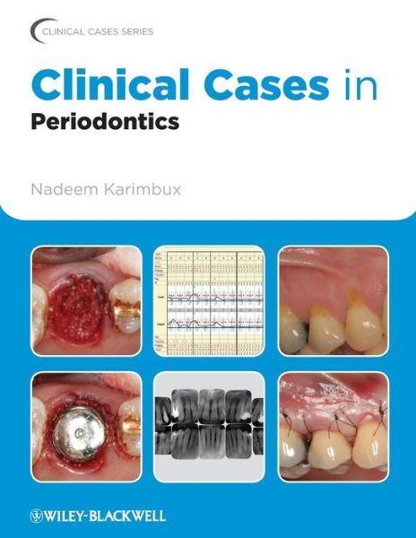 Cover for Nadeem Karimbux · Clinical Cases in Periodontics - Clinical Cases (Dentistry) (Paperback Book) (2011)