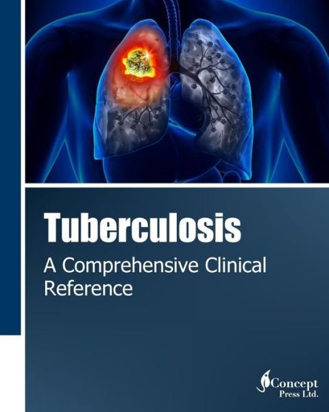 Cover for Iconcept Press · Tuberculosis: a Comprehensive Clinical Reference (Taschenbuch) (2014)