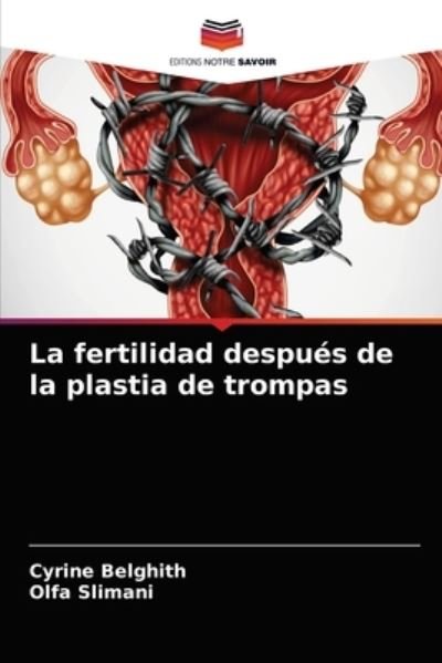 Cover for Cyrine Belghith · La fertilidad despues de la plastia de trompas (Pocketbok) (2021)