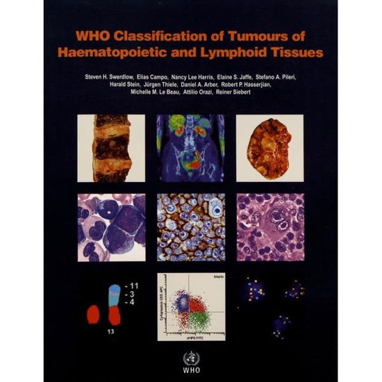 Cover for International Agency for Research on Cancer · WHO classification of tumours of haematopoietic and lymphoid tissues: Vol. 2 - World Health Organization Classification of Tumours (Paperback Book) [4th rev. edition] (2017)