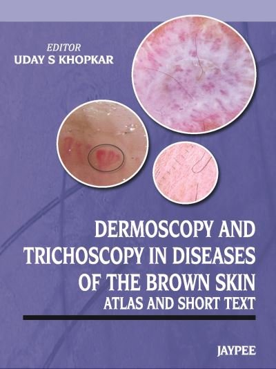 Cover for Uday S Khopkar · Dermoscopy and Trichoscopy in Diseases of the Brown Skin (Paperback Book) (2013)
