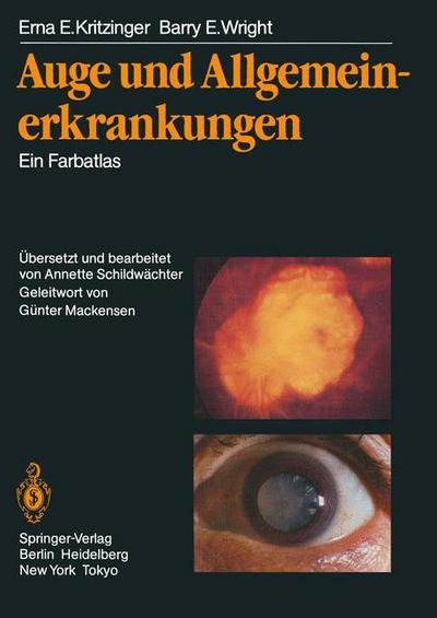 Cover for Erna E Kritzinger · Auge Und Allgemeinerkrankungen: Ein Farbatlas (Paperback Bog) [Softcover Reprint of the Original 1st 1985 edition] (2013)
