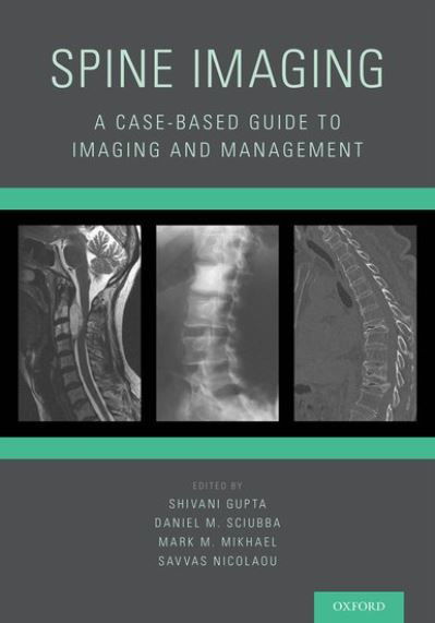 Spine Imaging: A Case-Based Guide to Imaging and Management -  - Bøker - Oxford University Press Inc - 9780199393947 - 17. mars 2016