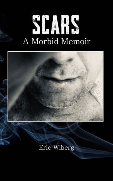 Cover for Eric Wiberg · Scars: A Morbid Memoir (Paperback Book) (2020)