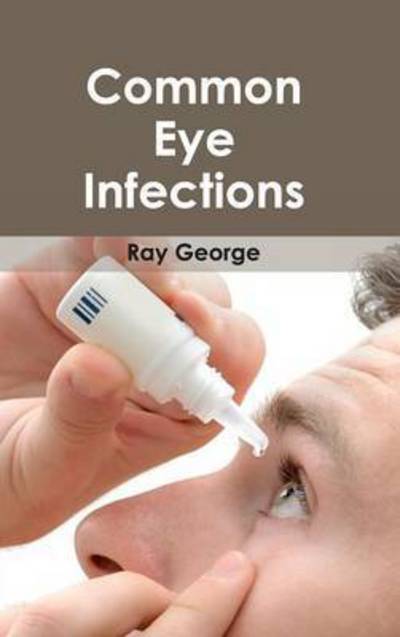 Cover for Ray George · Common Eye Infections (Hardcover Book) (2015)