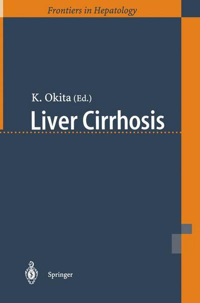 Liver Cirrhosis -  - Książki - Springer Verlag, Japan - 9784431702948 - 1 grudnia 2000