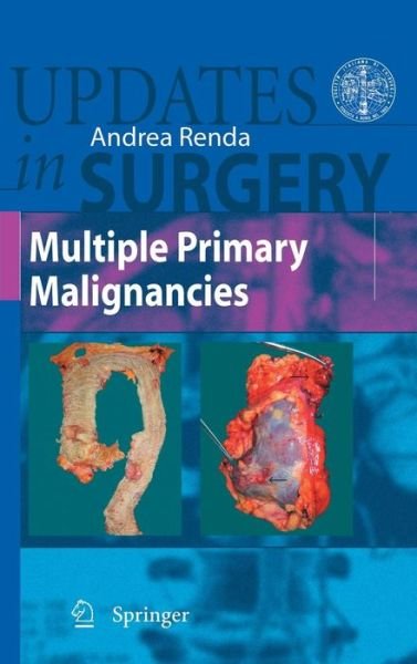 Andrea Renda · Multiple Primary Malignancies - Updates in Surgery (Hardcover bog) [2009 edition] (2008)