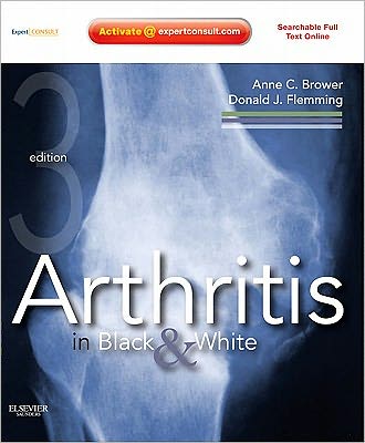 Cover for Brower, Anne C. (Professor and Chair of Radiology, Eastern Virginia Medical School, Norfolk, Virginia) · Arthritis in Black and White: Expert Consult - Online and Print (Hardcover Book) (2012)