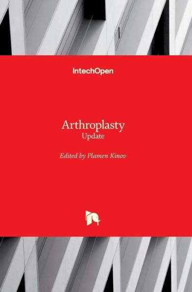 Cover for Plamen Kinov · Arthroplasty: Update (Hardcover Book) (2013)