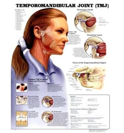 Cover for Acc 9932pl1.5 · Temporomandibular Joint (TMJ) Anatomical Chart (Map) (2000)