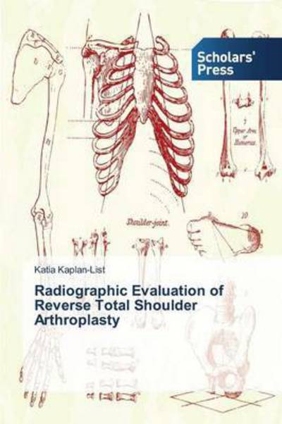 Cover for Kaplan-list Katia · Radiographic Evaluation of Reverse Total Shoulder Arthroplasty (Pocketbok) (2015)