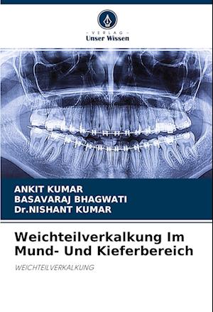 Cover for Ankit Kumar · Weichteilverkalkung Im Mund- Und Kieferbereich (Paperback Book) (2022)
