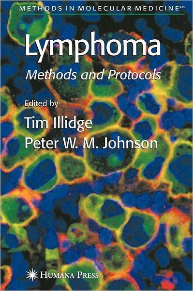 Cover for Tim Illidge · Lymphoma - Methods in Molecular Medicine (Paperback Book) [Softcover reprint of hardcover 1st ed. 2005 edition] (2010)