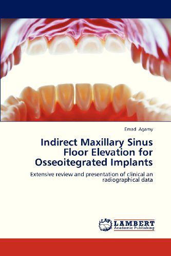 Cover for Emad Agamy · Indirect Maxillary Sinus Floor Elevation for Osseoitegrated Implants: Extensive Review and Presentation of Clinical an Radiographical Data (Paperback Bog) (2013)