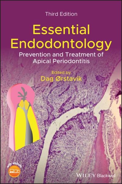 Cover for D Orstavik · Essential Endodontology: Prevention and Treatment of Apical Periodontitis (Innbunden bok) (2020)
