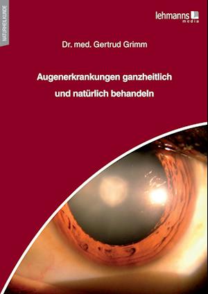 Augenerkrankungen ganzheitlich und natürlich behandeln - Gertrud Grimm - Books - Lehmanns Media GmbH - 9783965432956 - February 14, 2022