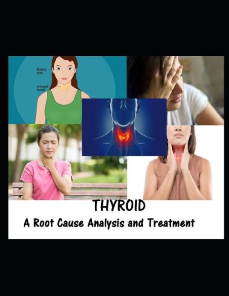 Cover for Ravi Kiran · Thyroid: A Root Cause Analysis and Treatment (Paperback Book) (2021)