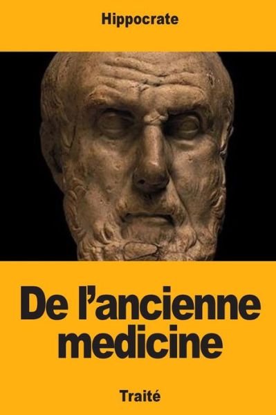 Cover for Hippocrate · De L'ancienne M Decine (Paperback Bog) (2018)