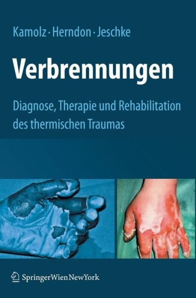Cover for Lars-peter Kamolz · Verbrennungen: Diagnose, Therapie Und Rehabilitation Des Thermischen Traumas (Gebundenes Buch) [2009 edition] (2009)