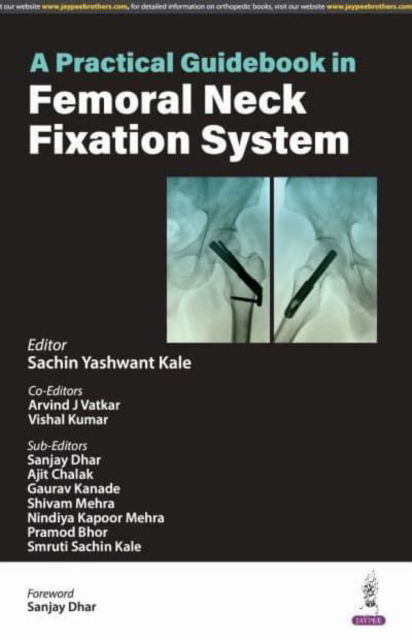 Cover for Sachin Yashwant Kale · A Practical Guidebook in Femoral Neck Fixation System (Paperback Book) (2024)