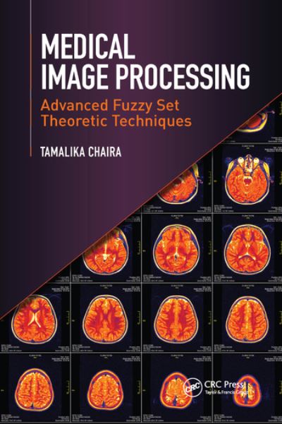 Cover for Tamalika Chaira · Medical Image Processing: Advanced Fuzzy Set Theoretic Techniques (Pocketbok) (2020)