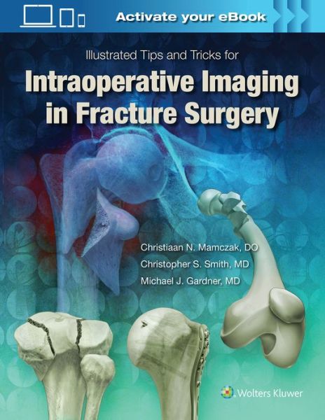 Cover for Michael J. Gardner · Illustrated Tips and Tricks for Intraoperative Imaging in Fracture Surgery (Hardcover Book) [First edition] (2017)