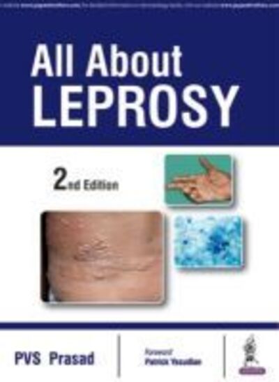 Cover for Prasad · All About Leprosy 2nd Ed 37132 (Pocketbok) (2016)