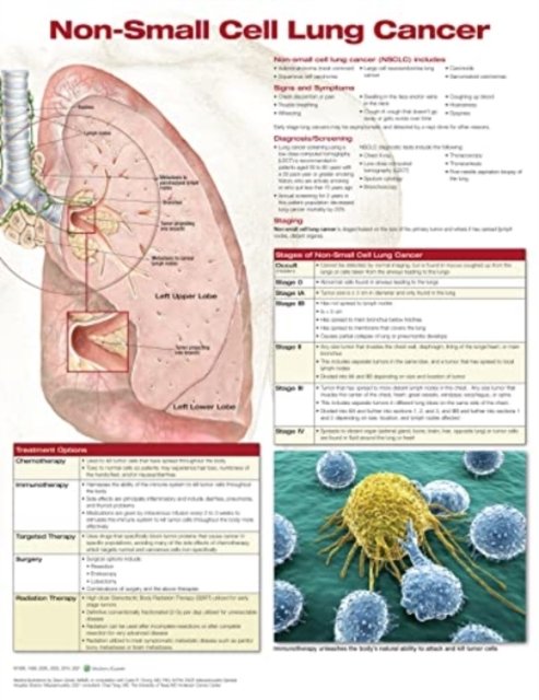 Cover for Anatomical Chart Company · Non-Small Cell Lung Cancer, Chart Laminated (Poster) (2021)