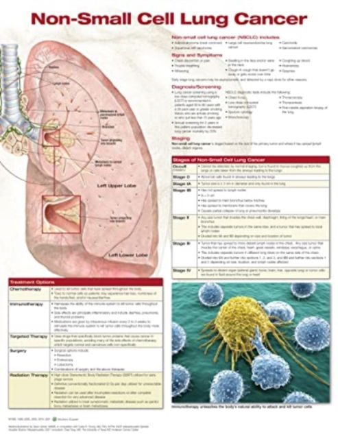 Non-Small Cell Lung Cancer, Chart Laminated - Anatomical Chart Company - Merchandise - Wolters Kluwer Health - 9781975185961 - December 1, 2021