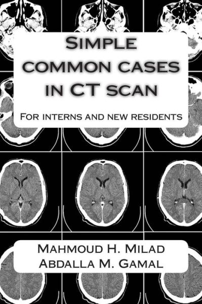 Cover for Dr Abdalla M Gamal · Simple Common Cases in Ct Scan: for Interns and New Residents (Paperback Book) (2015)