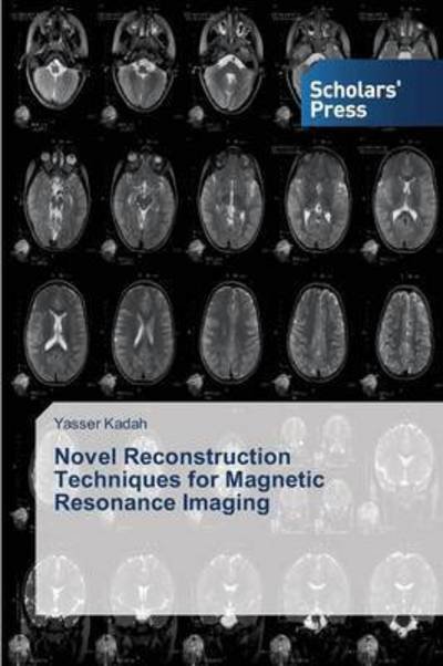 Cover for Kadah Yasser · Novel Reconstruction Techniques for Magnetic Resonance Imaging (Paperback Book) (2015)