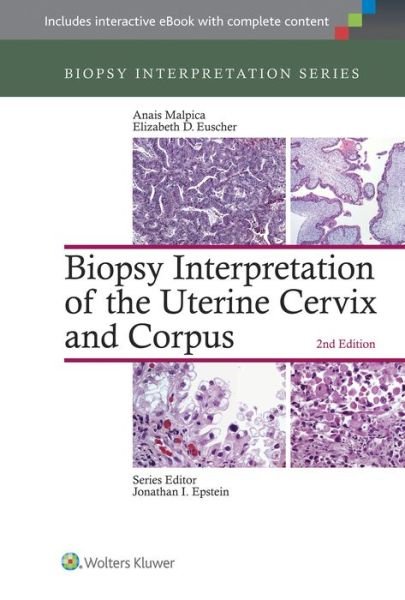 Cover for Anais Malpica · Biopsy Interpretation of the Uterine Cervix and Corpus - Biopsy Interpretation Series (Hardcover Book) (2015)