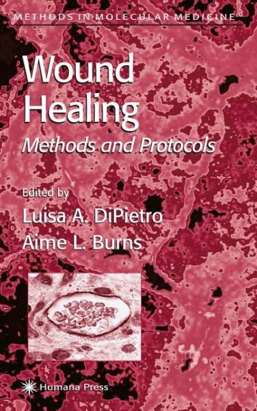 Cover for Luisa a Dipietro · Wound Healing: Methods and Protocols - Methods in Molecular Medicine (Paperback Book) [Softcover reprint of hardcover 1st ed. 2003 edition] (2010)