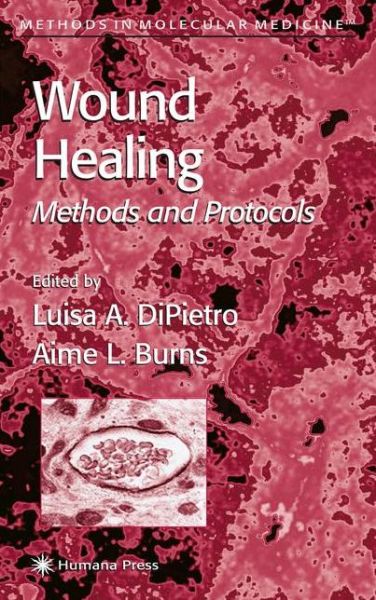 Wound Healing: Methods and Protocols - Methods in Molecular Medicine - Luisa a Dipietro - Books - Humana Press Inc. - 9781617372964 - November 9, 2010
