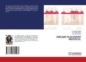 Cover for Mehta · Implant Placement Protocol (N/A)