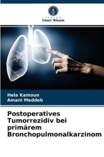 Cover for Hela Kamoun · Postoperatives Tumorrezidiv bei primarem Bronchopulmonalkarzinom (Paperback Book) (2021)