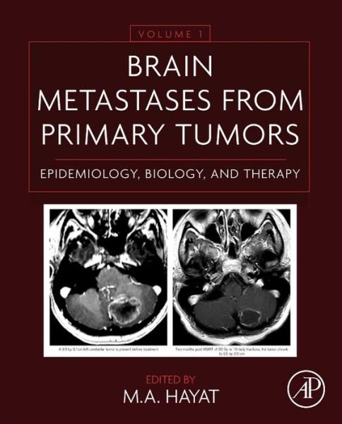 Cover for M a Hayat · Brain Metastases from Primary Tumors Volume 1: Epidemiology, Biology, and Therapy (Inbunden Bok) (2014)
