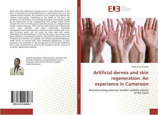 Cover for Nana · Artificial dermis and skin regener (Book)