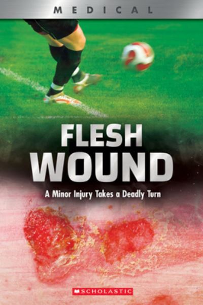 Cover for Shea Phillips · Flesh Wound: A Minor Injury Takes a Deadly Turn (XBooks) - Xbooks (Taschenbuch) (2020)