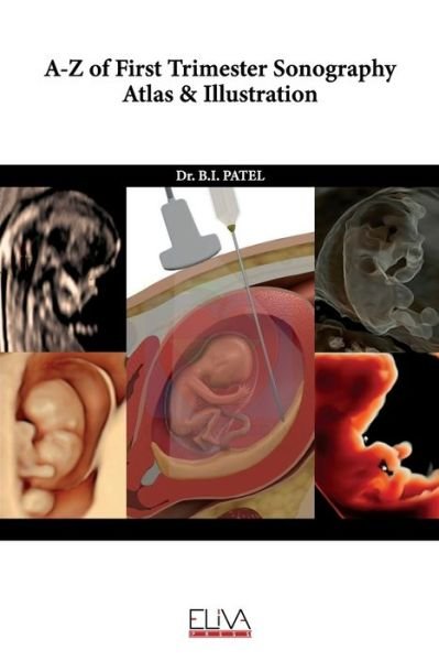 Cover for B I Patel · A-Z of First Trimester Sonography Atlas &amp; Illustration (Paperback Book) (2021)