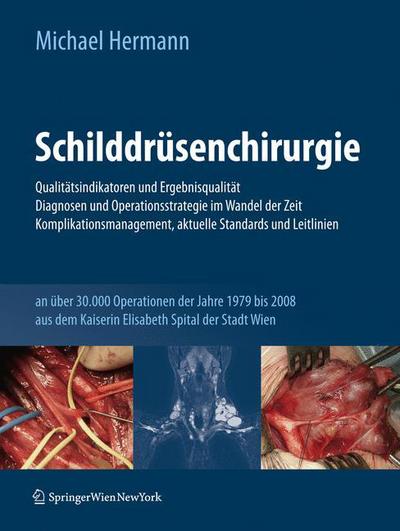 Cover for Michael Hermann · Schilddrusenchirurgie - Qualitatsindikatoren und Ergebnisqualitat, Diagnosen und Operationsstrategie im Wandel der Zeit, Komplikationsmanagement, aktuelle Standards und Leitlinien: an uber 30.000 Operationen der Jahre 1979-2008 aus dem Kaiserin Elisabeth  (Hardcover Book) [German, 2011 edition] (2010)