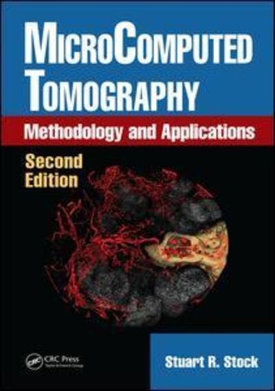 Cover for Stock, Stuart R. (Northwestern University, Evanston, Illinois, USA) · MicroComputed Tomography: Methodology and Applications, Second Edition (Hardcover bog) (2019)